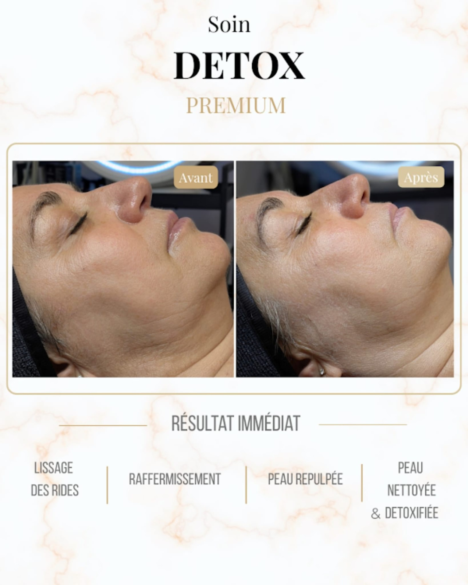 Avant / après du soin Detox Premium chez Âméa